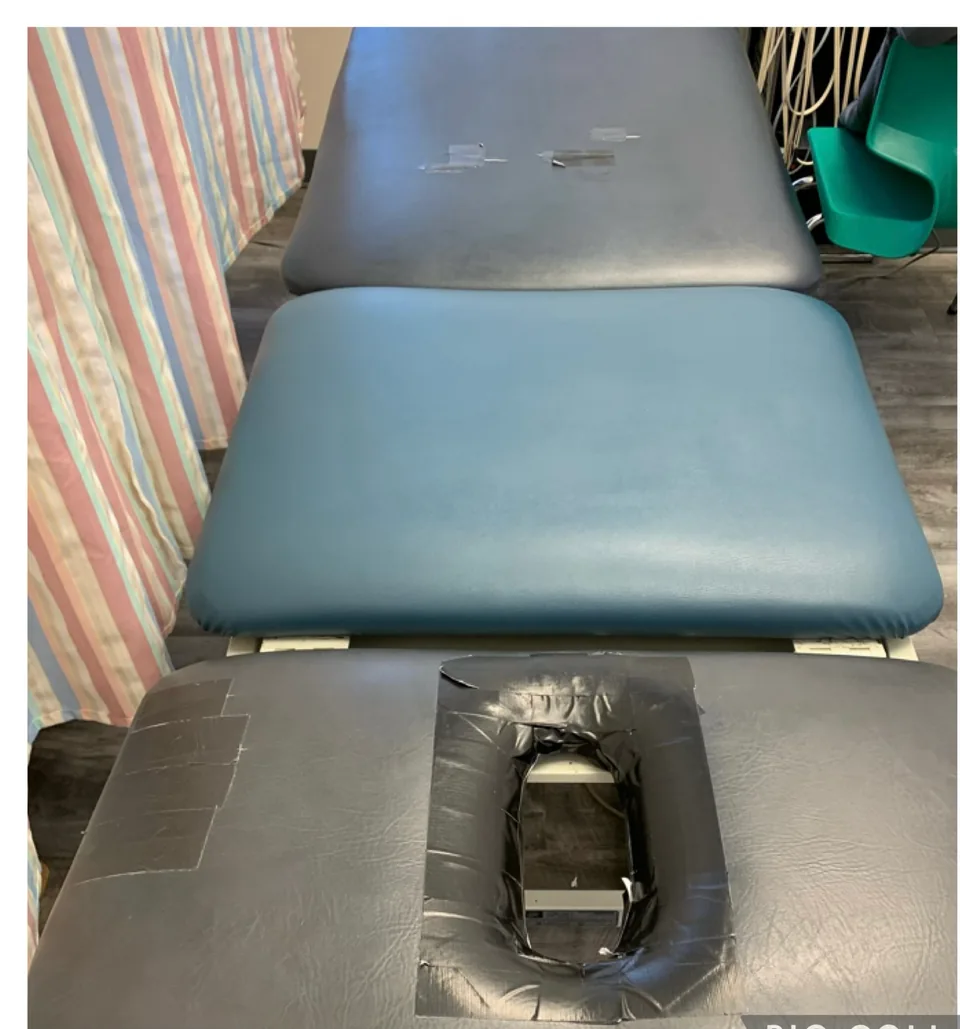 Worn black upholstery with a taped, damaged face opening on a SEERS 3 treatment table before reupholstery.
